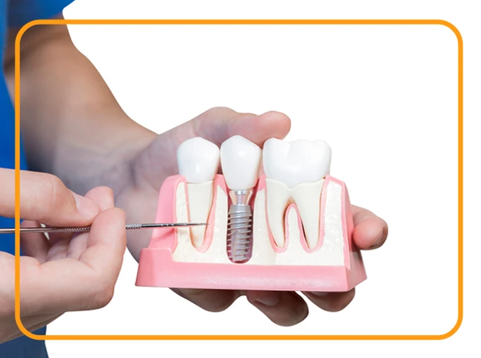 دستیار دندانپزشک(ایمپلنتولوژیست)