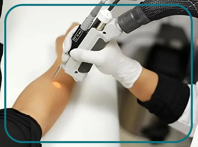 دوره آموزشی تربیت اپراتور لیزر (پیراپزشکان)