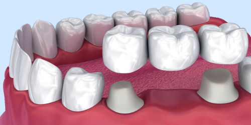 /center/3/course/76/