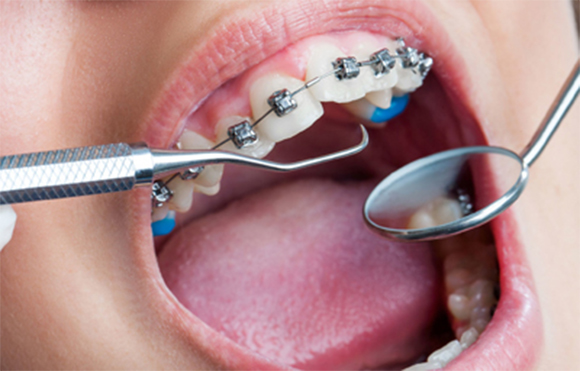 دستیار دندانپزشک تخصصی ارتودنسی